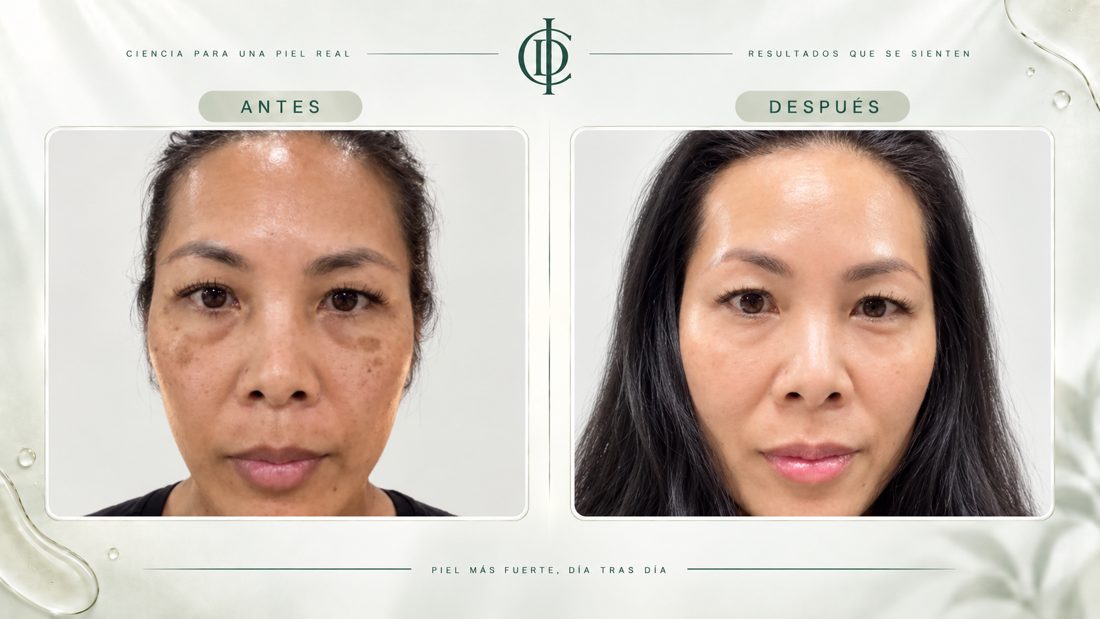 Testimonio ICD 10